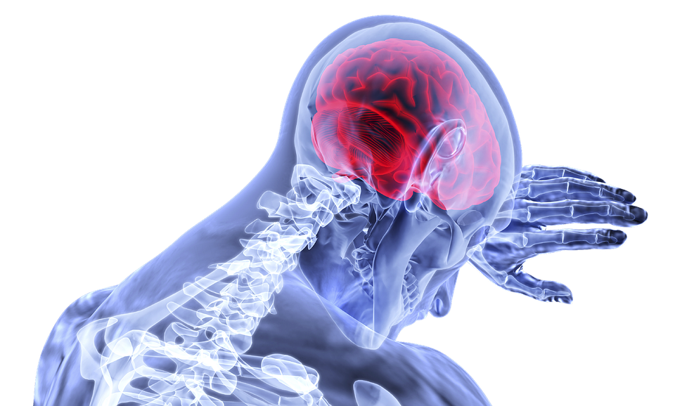 brain stroke